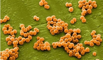 糧食真菌毒素 糧食真菌毒素